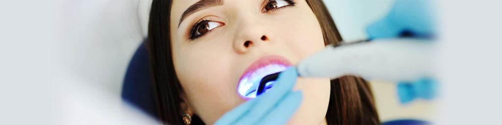 do-dental-fillings-last-forever TLC Dental Care Knoxville, TN 