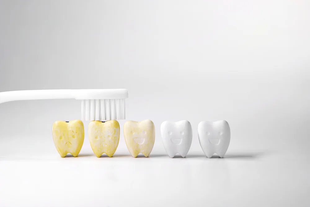 teeth whitening