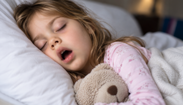 Child sleeping with mouth open, a possible sign of pediatric sleep-disordered breathing